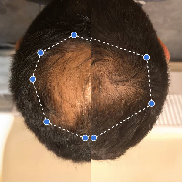 Avant / Après — 6 mois