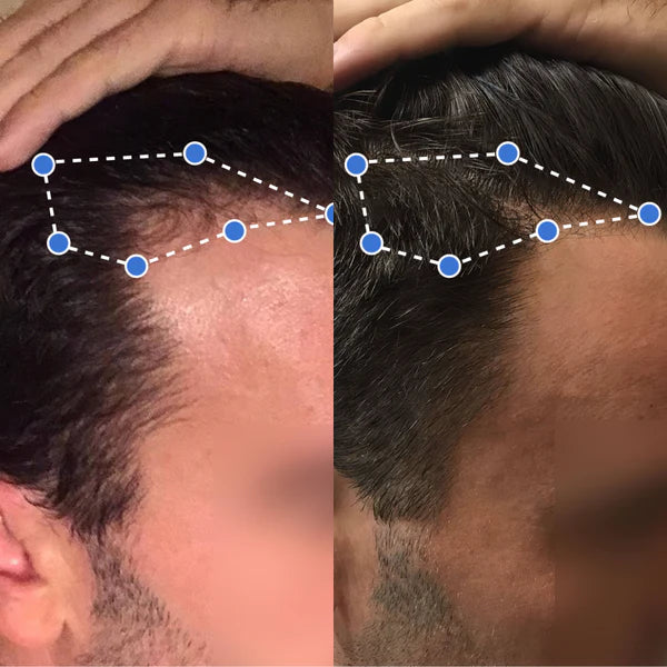 Avant / Après — 3 mois