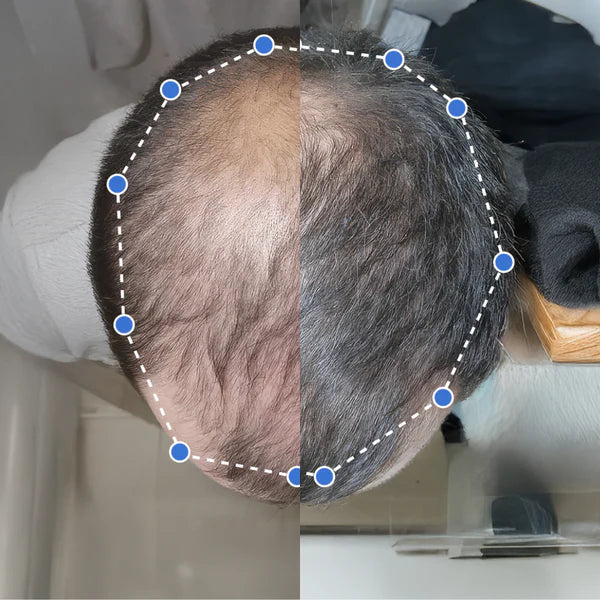 Avant / Après — 5 mois